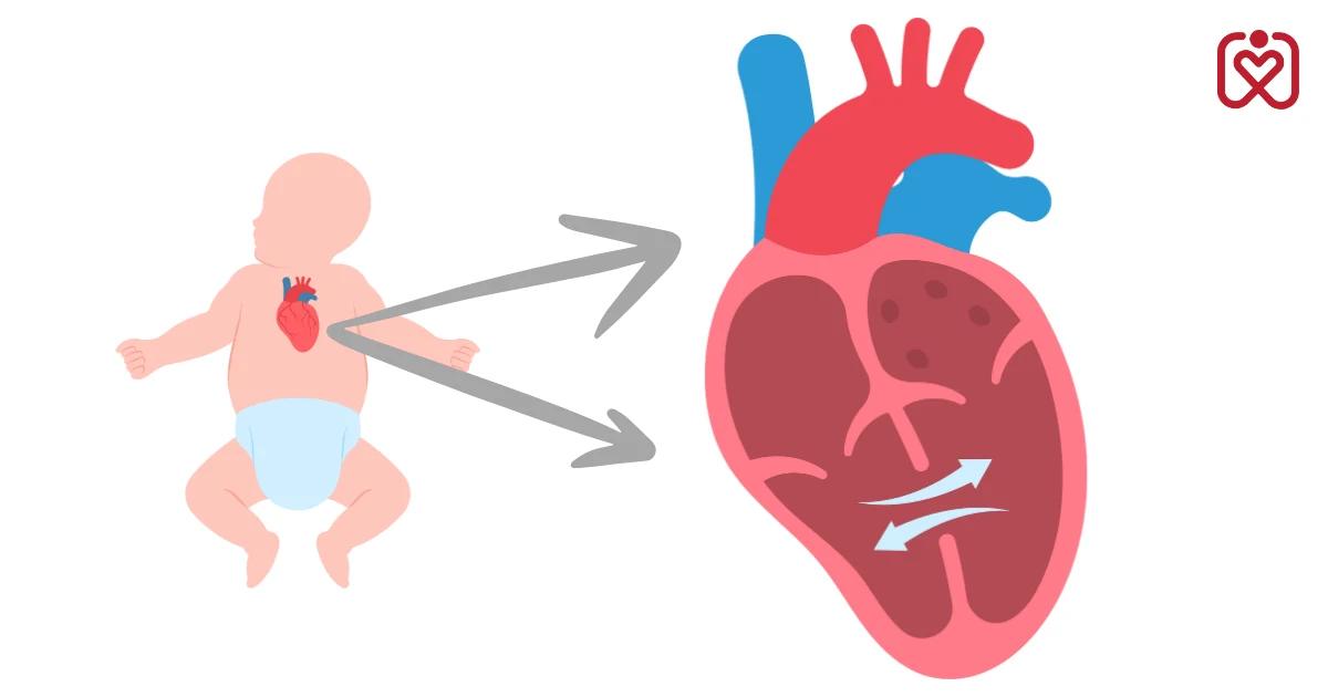 What Are the Causes of Congenital Heart Defects? Identifying Risk Factors