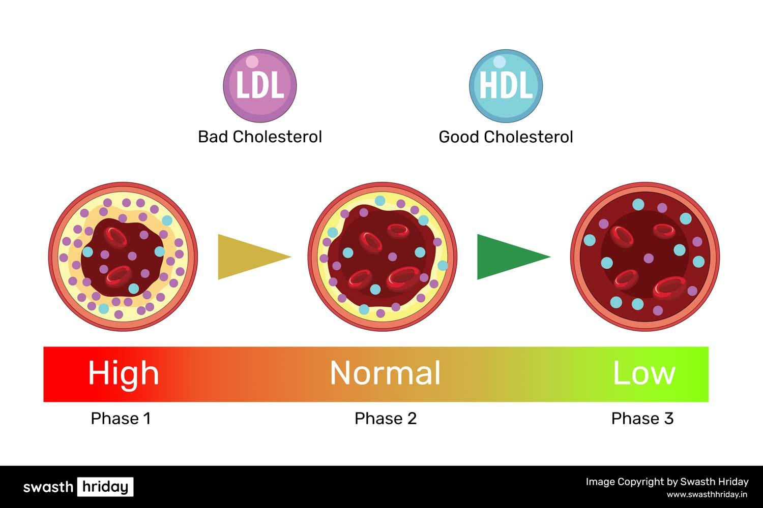 Aerobic vs. Strength Training: Benefits for Heart Health and Risk Reduction कोरोनरी आर्टरी डिज़ीज़ और व्यायाम: शारीरिक गतिविधि कैसे करती है मदद